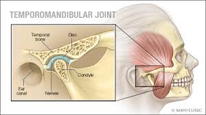 The disk erodes or moves out of its proper alignment Can Physiotherapy Help Tmj Treat Tmj Dysfuntion