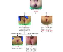 Image result for Perianal Abscess