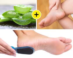 This can be very damaging for our feet as it can lead us to have dry feet, asperities, calluses and other fungal infections. 10 Fast Ways To Get Rid Of Calluses And Get Baby Soft Feet