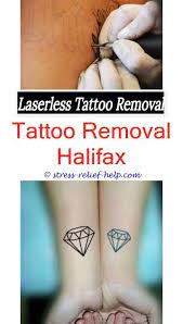 Tattoo Lightening How Effective Is Laser Tattoo Removal 2015 Home Tattoo Removal Kit Average Cost O Tattoo Removal Cost Tattoo Removal Tattoo Removal Results