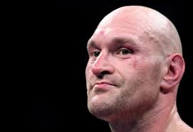 Dillian Whyte BLASTS Anthony Joshua over Jarrell Miller as Tyson Fury