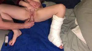 Broken ankle porn - sushikoi.mx