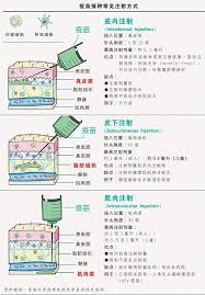 Search for text in url. ç–«è‹—æ³¨å°„3æ–¹å¼