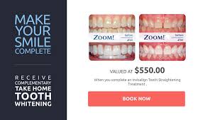 Teeth whitening typically costs between $99 to $367 per session: How Much Will My Teeth Whitening Cost Shore Dental