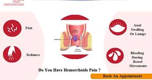 Symptoms Of Hemorrhoids Hemorrhoids Hospital Best Doctors