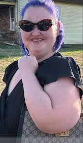 Amy's Hair Color and Dental Issues