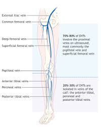 Dvt Diagram Technical Diagrams
