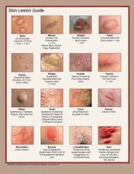 Rashes