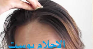 فوائد الثوم للشعر وطريقة استخدامة لتطويل وتنعيم وتكثيف الشعر Hair Styles Hair Long Hair Styles