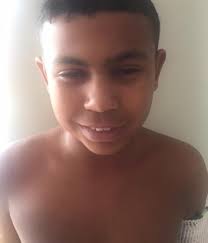 13-year-old Maryland boy survives freak accident with 6-inch screw lodged  in his skull