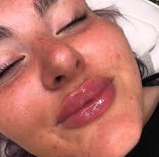 Nice to see the 725 serving the Chelwood Avenue bus stop again after all  that debacle with it. :)