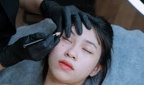 Phun mày thẩm mỹ