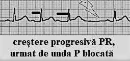 Con el simple bloc de notas, te bastará y te sobrará 512mb de ram xd jajaja. Interpretarea TulburÄrilor De Conducere Ale Inimii Pe Ekg NoÈiuni De Fiziopatologie Pentru StudenÈi Newsmed Ro