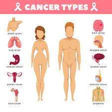 Testicular Cancer – Symptoms, Diagnosis And Treatment | Metromale Clinic &  Fertility Center