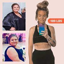 Nose job before and after plastic surgery. Gastric Bypass Surgery Before And After I Lost 189 Pounds