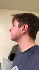 18m I Ve Always Had A Weak Jawline And Chipmunk Cheeks Making Me Look Younger And Less Masculine Any Suggestions For Facial Definition Specifically Jawline Jawsurgery