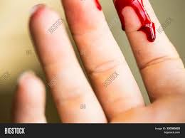 Definitions by the largest idiom dictionary. Finger Cut Bleeding Image Photo Free Trial Bigstock