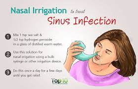 Home Remedies For A Sinus Infection Top 10 Home Remedies Sinus Remedies Sinus Infection Remedies Sinusitis