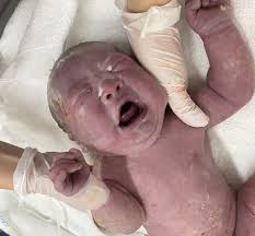 私が産んだ子？｣ダウン症と診断され、人生終わったと思った。1歳になる前に2度の心臓手術を乗り越えて…【体験談】｜たまひよ