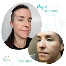 Enilsa Brown (@enilsaskinessentials) • Instagram photos and videos