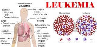The next section in this guide is diagnosis. Leukemia Cancer Treatment Cost In India Best Hospital For Leukemia Treatment In India
