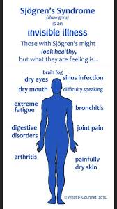 Sjogren S Syndrome In 2020 Sjogrens Sjogrens Syndrome Syndrome