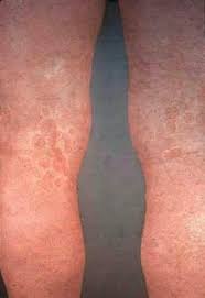 Image result for Eriosema ukingense