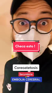 COREOATETOSIS SEC EMBOLIA CEREBRAL #drnavarroneurologia #neurologo  #monterrey #evc #neuro #parati #fyp #resonancia #hospital #cerebro  #tratamiento #do