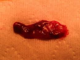 We did not find results for: Signs Of Miscarriage Top 5 Early Miscarriage Symptoms