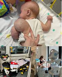 Baby fighting cancer diagnosis and treatment