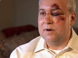 The Detroit News and WJBK-TV report Monday that Dearborn City Councilman Robert Abraham received four stitches near his eye and suffered other ... - bob-abraham-dearbornjpg-891752e1ed8172fe