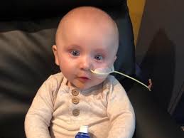 Little 6 month old Lachie's surgery journey