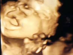 Avalea Elizabeth Eckert's Memorial Website