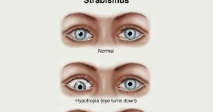 Image result for Cover Test