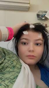 Living with epilepsy and seeking support