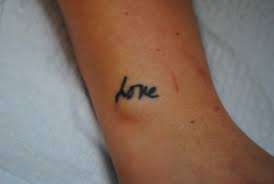 Quickly fade your unwanted tattoo. Before After Oregon Aesthetics Laser Tattoo Removal Oregon Aesthetics Laser Tattoo Removal