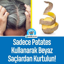 Sadece Patates Kullanarak Olusan Beyaz Saclardan Kurtulun Beyaz Sac