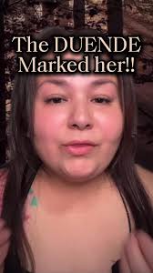 True Horror: The Terrifying Bite of Duendes Revealed!