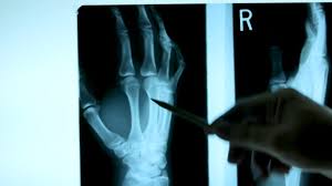 6 167 X Ray Image Videos And Hd Footage Getty Images