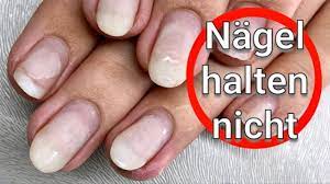 Unterschiede zwischen gel & acryl ? Gel Oder Acrylnagel Halten Plotzlich Nicht Mehr Nageltyp Analyse Trockene Nagel Youtube