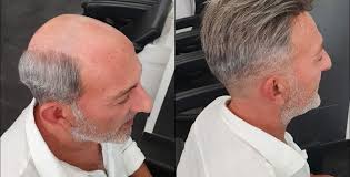 Sei di torino e sei vuoi la correzione della calvizie con il trapianto capelli esclusivo micro fue? Etica Le Griffe Parrucchiere E Parrucche Torino
