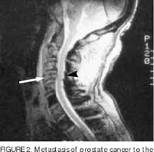 But hearing the words can still be scary. Figure 2 From Recognizing Spinal Cord Emergencies Semantic Scholar