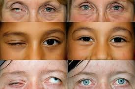 Book review: Ophthalmology 5th edition