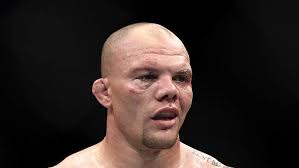 Последние твиты от anthony smith (@lionheartasmith). Anthony Smith S Teeth And Memorable Ufc Fight Night Images Heavy Com