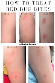 Image result for bedbug bites look like