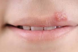 Pin En Salud Dental