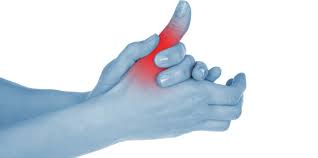 Reumatismos De Partes Moles Artrite Reumatoide Dor Compartilhada E Dor Diminuida
