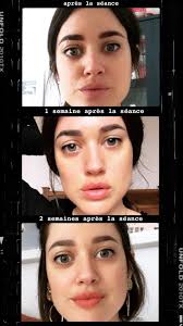 Les stars ont retrouvé de belles lignes de sourcils. Dermopigmentation Des Sourcils L Atelier D Al