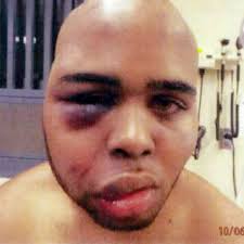 N.Y. prison guards beat inmate hours before his suicide: suit