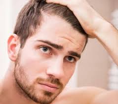 Frisuren Mit Geheimratsecken Fur Manner Haarschnitt Haaransatz Verdecken Frisur Geheimratsecken Geheimratsecken Kurze Haare Zopfe